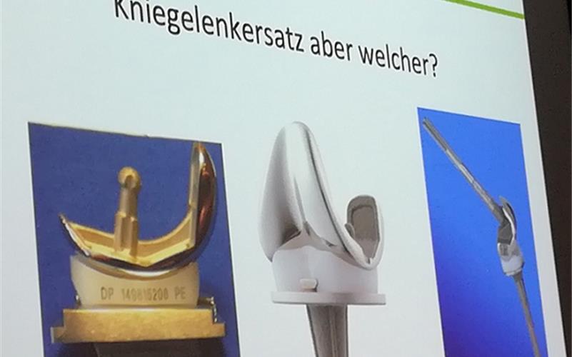 Nur erprobte Implantate im Einsatz