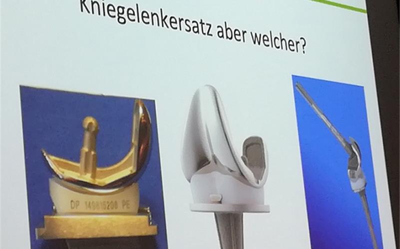 Nur erprobte Implantate im Einsatz Dr. Maihoff zeigte eine Auswahl an KniegelenkersatzGB-Foto: gb